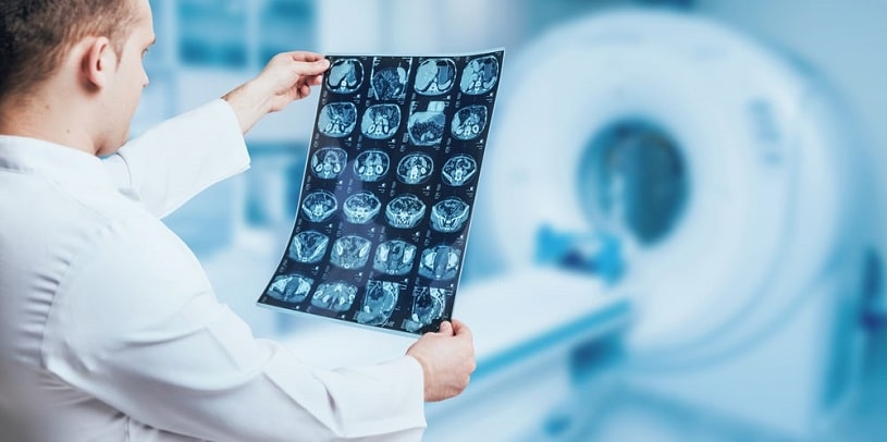 Doctor examining marijuanas effects on patient's brain.
