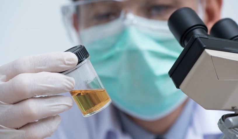 Technician examining a urine sample.