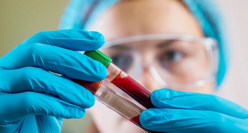 Lab worker checking the blood sample.