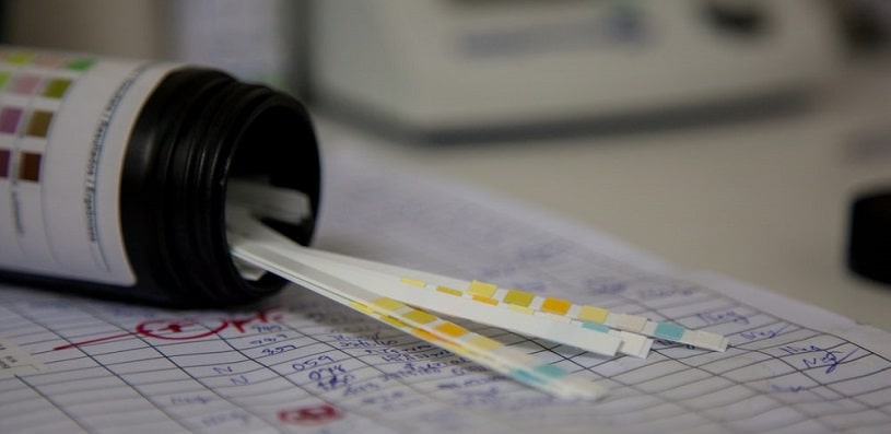 Urine test strips on the papers.