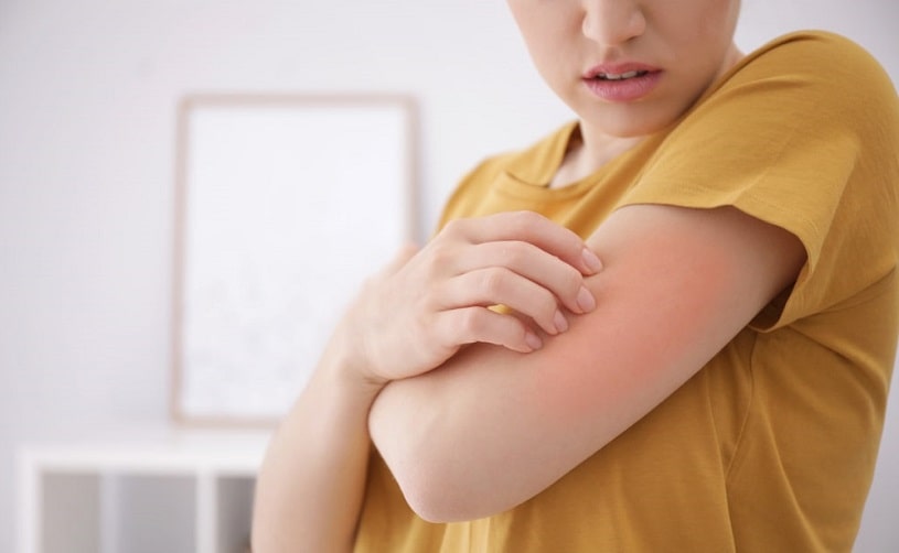 Allergic reaction to Ritalin, woman scratching her arm.