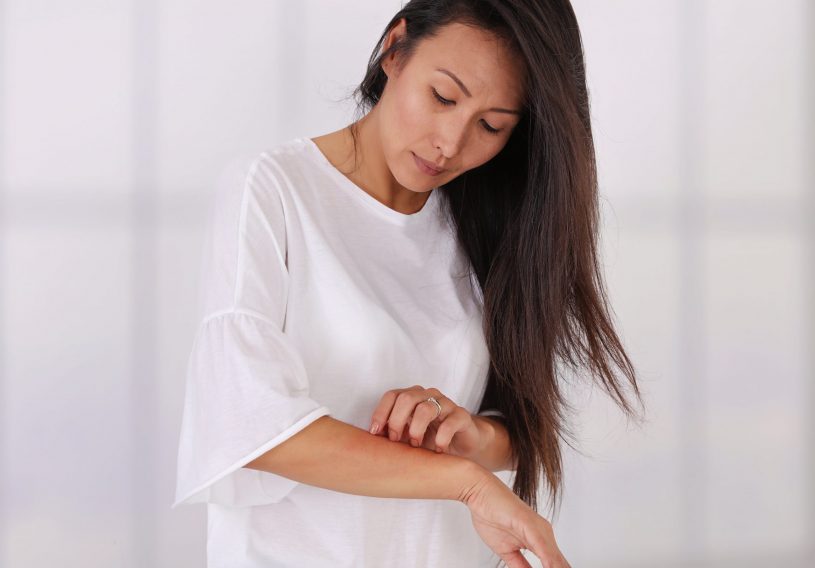 Woman noticed allergic reaction from Restoril.