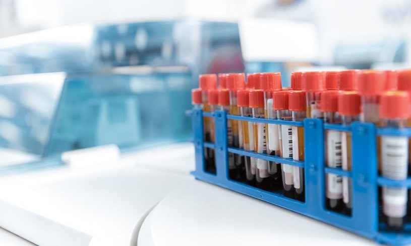 Blood test samples in tubes.